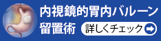 内視鏡的胃内バルーン留置術