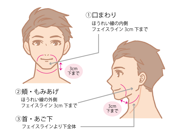 ひげ脱毛