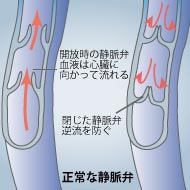 正常な静脈弁