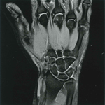 手の関節の画像